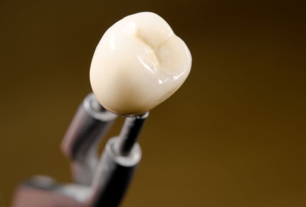 How To Take Care Of Dental Crowns