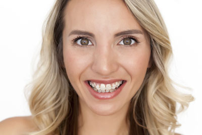 Why You Should Visit An Implant Dentist To Replace Your Tooth
