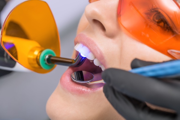 Professional Teeth Whitening And The Science Behind It